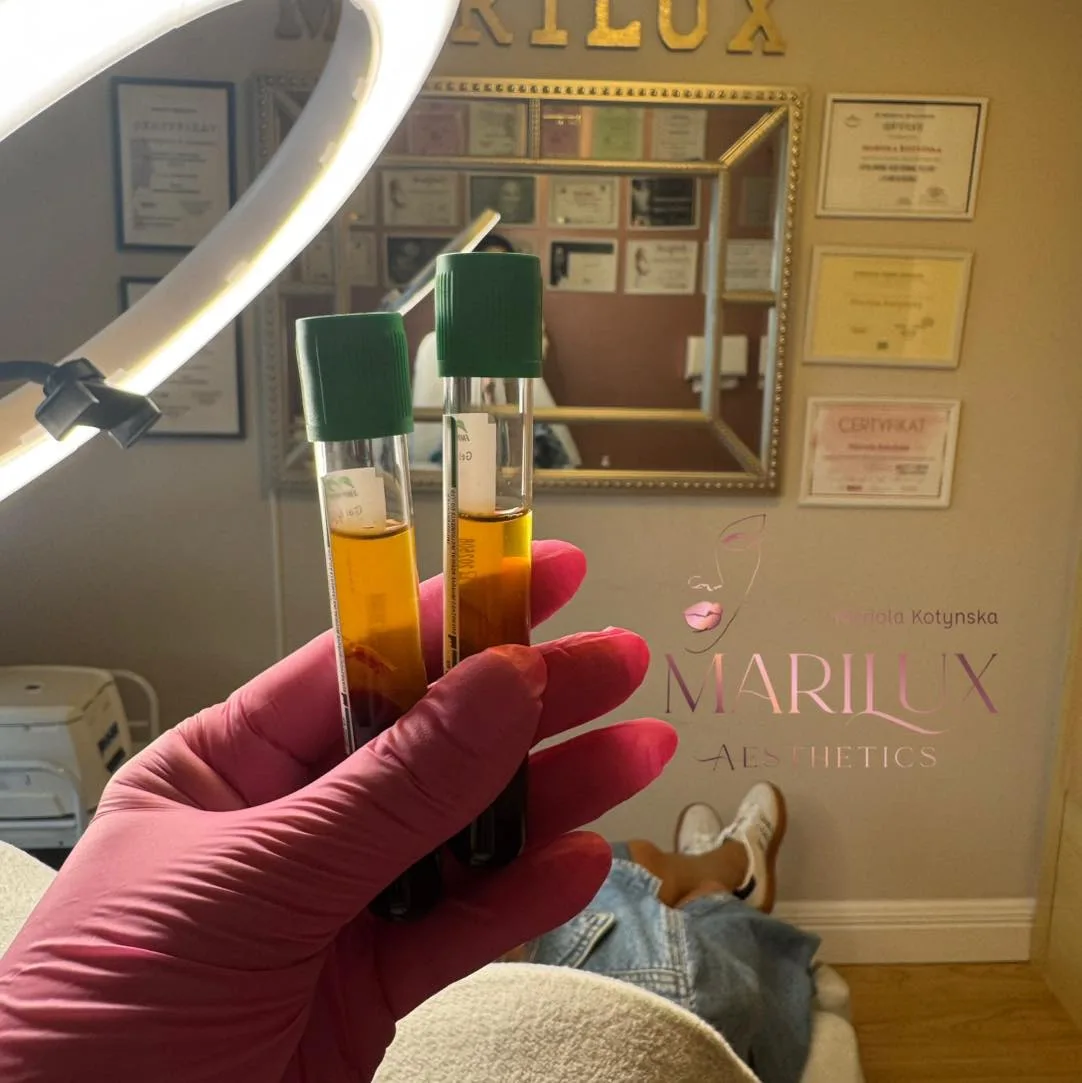 PRP Therapy — platelet rich plasma treatment vials by Marilux Aesthetics